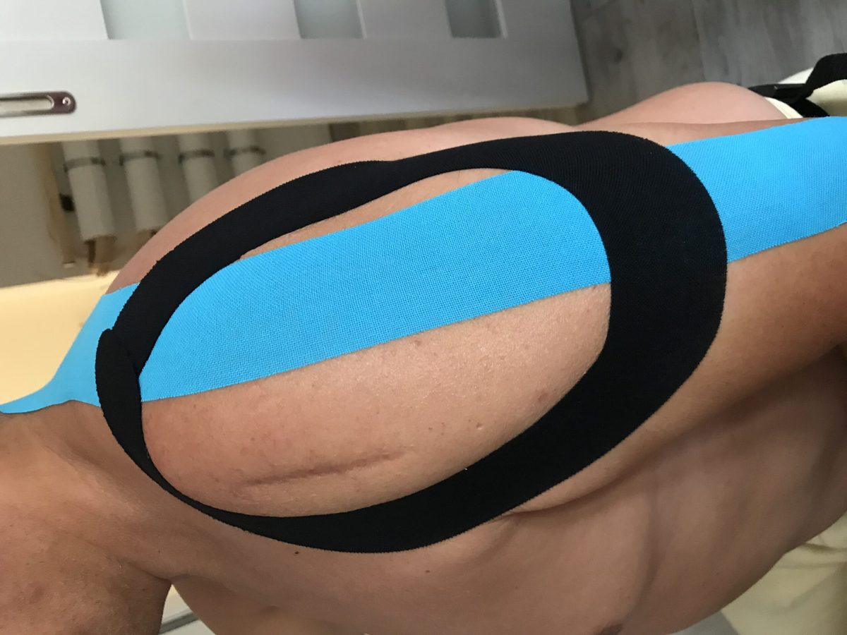 Kinesiologie-Tape auf dem Unterarm als ergänzende Anwendung